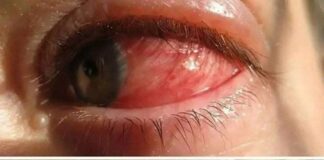 Could Your Mouth Be Sending a Warning? Early Signs of Oral Cancer to Watch For