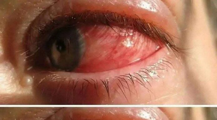 Could Your Mouth Be Sending a Warning? Early Signs of Oral Cancer to Watch For