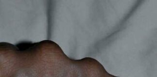 Visible Veins Explained: Normal Causes, Health Risks, and When to Worry