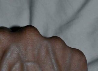 Visible Veins Explained: Normal Causes, Health Risks, and When to Worry