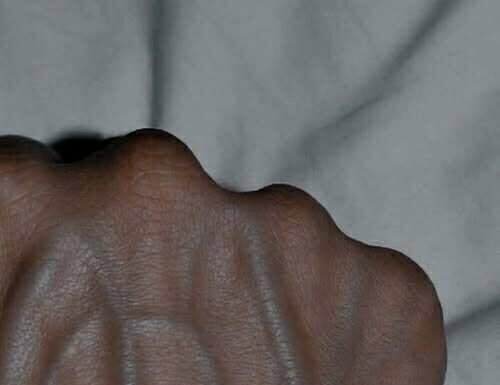 Visible Veins Explained: Normal Causes, Health Risks, and When to Worry