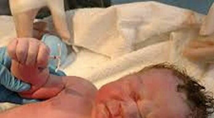 The Baby Who ‘Defied’ Birth Control: A Viral Story of Fate and Surprise