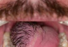 The Hidden Costs of Sleeping with the Wrong Person: What You Need to Know