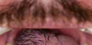 The Hidden Costs of Sleeping with the Wrong Person: What You Need to Know