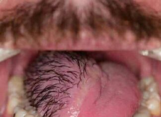 The Hidden Costs of Sleeping with the Wrong Person: What You Need to Know