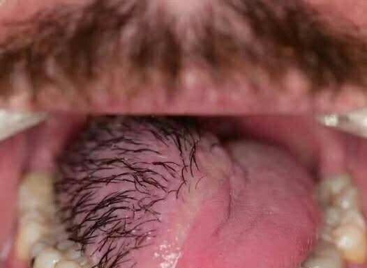 The Hidden Costs of Sleeping with the Wrong Person: What You Need to Know