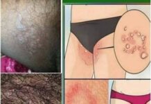 Stomach Cancer Symptoms: From Subtle Signals to Serious Red Flags