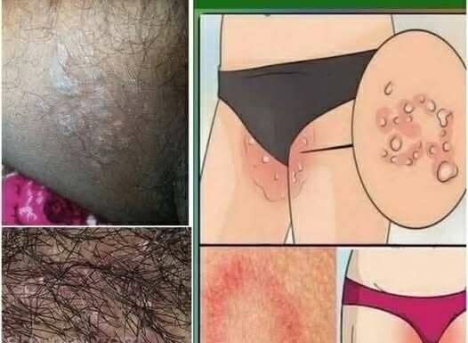 Stomach Cancer Symptoms: From Subtle Signals to Serious Red Flags