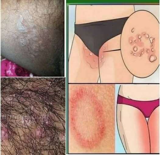 Stomach Cancer Symptoms: From Subtle Signals to Serious Red Flags