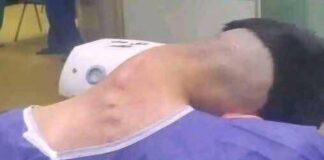 Neck Collapse Alert: Young Man Hospitalized with Dropped Head Syndrome