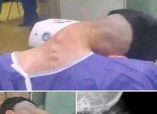Neck Collapse Alert: Young Man Hospitalized with Dropped Head Syndrome