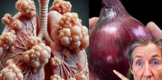 Constant coughing or mucus buildup? Try this powerful onion remedy