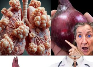 Constant coughing or mucus buildup? Try this powerful onion remedy