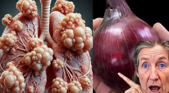 Constant coughing or mucus buildup? Try this powerful onion remedy