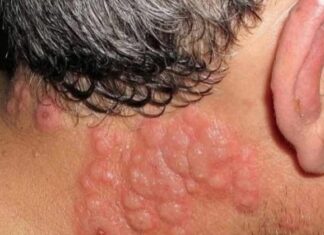 Why many experts advise against sleeping with window open