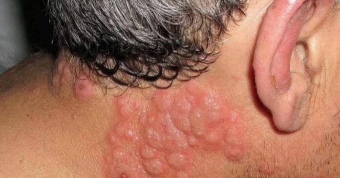 Why many experts advise against sleeping with window open