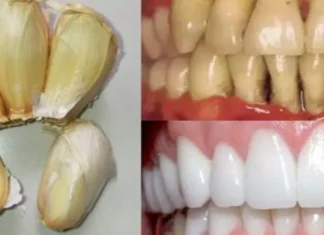 Improve your oral health naturally with garlic