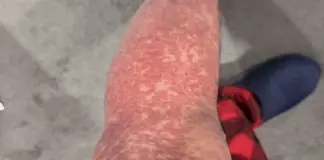 What Your Skin Could Be Telling You About Hidden Health Issues