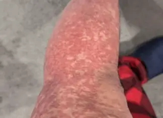 What Your Skin Could Be Telling You About Hidden Health Issues