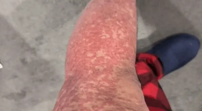 What Your Skin Could Be Telling You About Hidden Health Issues