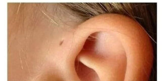 Here is what this little hole on the ear mean