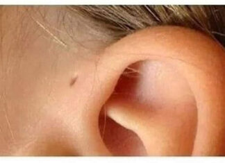 Here is what this little hole on the ear mean
