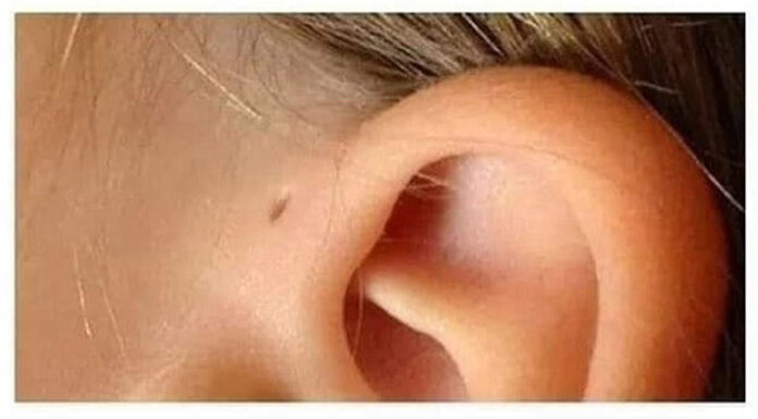 Here is what this little hole on the ear mean