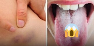 11 warning signs your body gives about your health