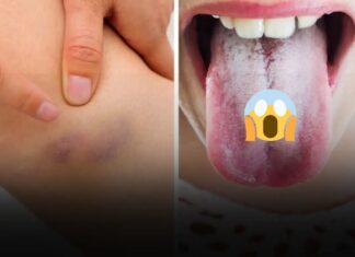 11 warning signs your body gives about your health