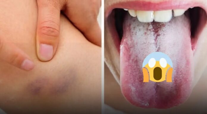 11 warning signs your body gives about your health