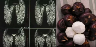 Just one bite can do serious damage — and shockingly, people can’t stop eating it