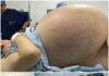 Tears of Joy Turn to Shock: A Pregnant Woman Expecting Triplets Leaves Doctors Stunned by Terrifying Discovery During C-Section