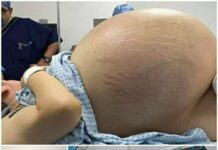 Tears of Joy Turn to Shock: A Pregnant Woman Expecting Triplets Leaves Doctors Stunned by Terrifying Discovery During C-Section