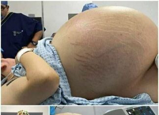 Tears of Joy Turn to Shock: A Pregnant Woman Expecting Triplets Leaves Doctors Stunned by Terrifying Discovery During C-Section