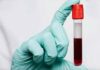 The Surprising Link Between Blood Type and Aging—What Science Reveals