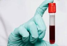 The Surprising Link Between Blood Type and Aging—What Science Reveals