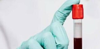 The Surprising Link Between Blood Type and Aging—What Science Reveals