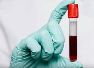 The Surprising Link Between Blood Type and Aging—What Science Reveals