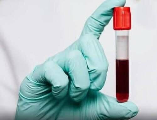 The Surprising Link Between Blood Type and Aging—What Science Reveals