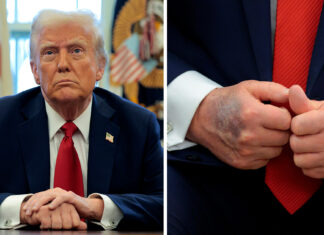 Donald Trump suffered a stroke last year, claims doctor