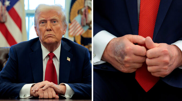Donald Trump suffered a stroke last year, claims doctor