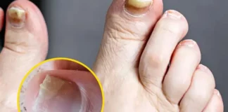 Health expert warns of two silent feet killers and how to spot them