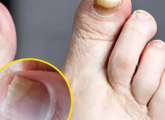 Health expert warns of two silent feet killers and how to spot them