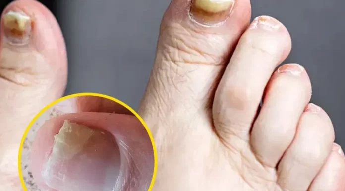Health expert warns of two silent feet killers and how to spot them