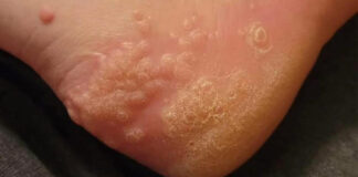 These are the consequences of wearing used…
