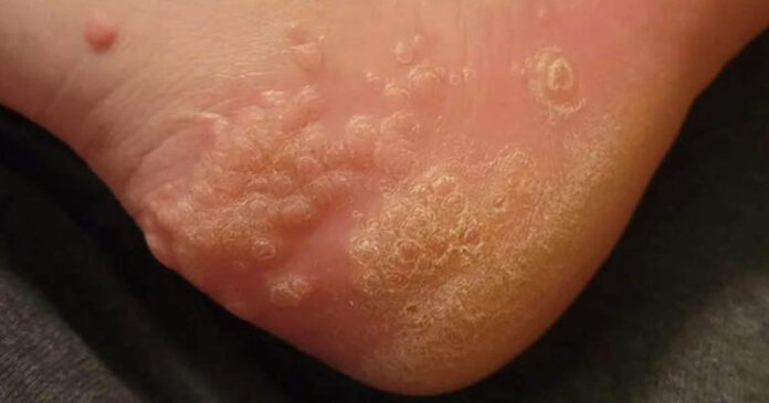 These are the consequences of wearing used…