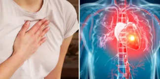 A subtle heart attack symptom in women that is often overlooked
