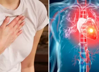 A subtle heart attack symptom in women that is often overlooked
