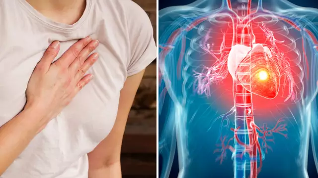 A subtle heart attack symptom in women that is often overlooked