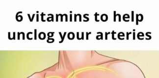 6 vitamins that can help with clogged arteries